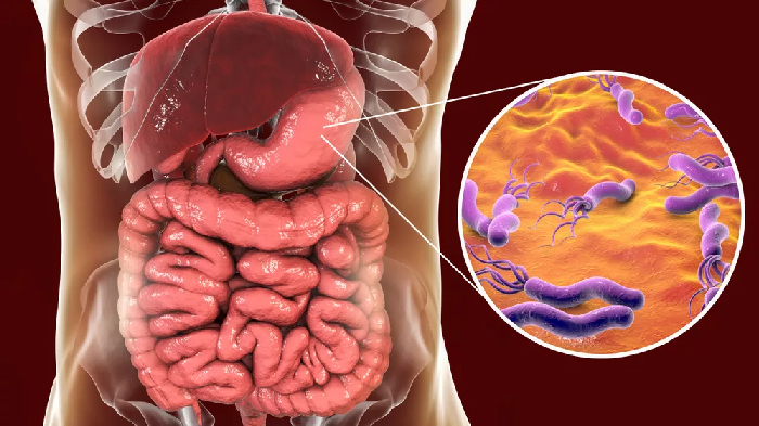 Черный орех в лечении H pylori